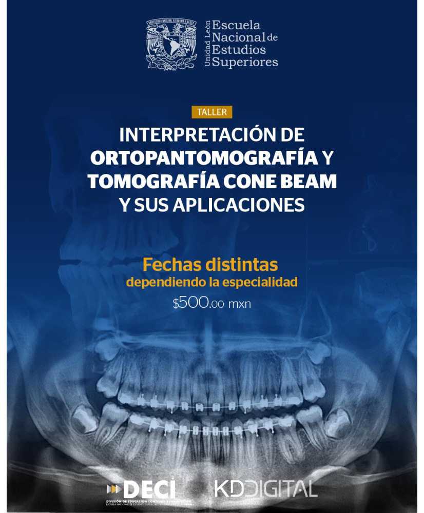 Admisión al Taller: Interpretación de Ortopantomografía y Tomografía CONE BEAM y sus aplicaciones